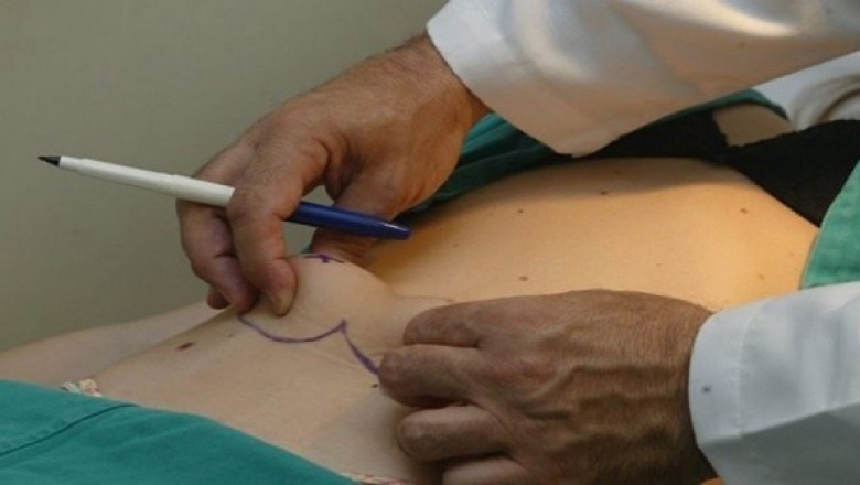 Cirurgião plástico deve garantir êxito do procedimento estético