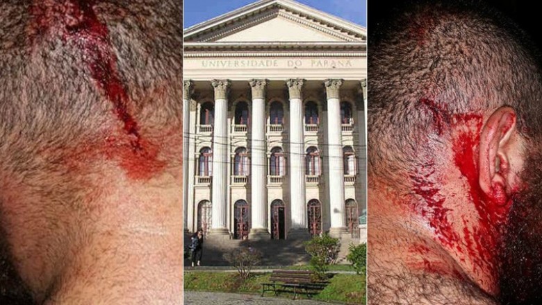 Identificados 5 suspeitos de ligação com agressores de jovem no Paraná