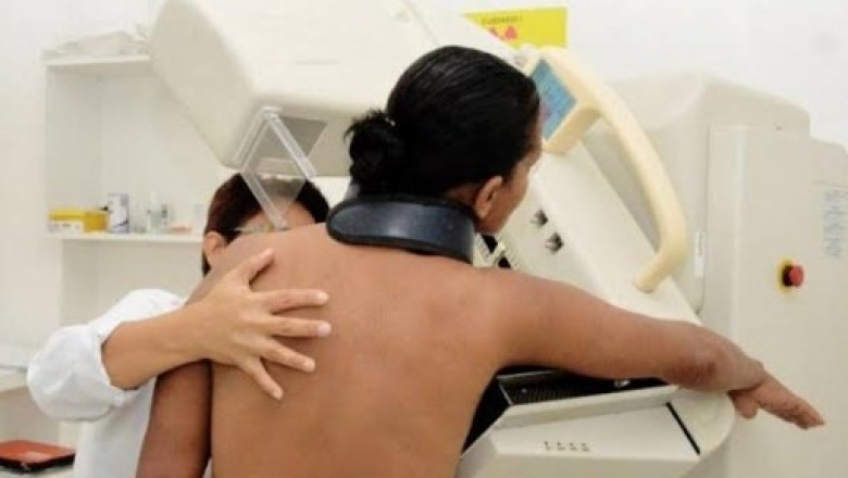 Uma em cada 12 mulheres receberá diagnóstico de câncer de mama
