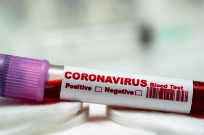 Brasil tem 59 mortes por coronavírus e 2.554 casos confirmados