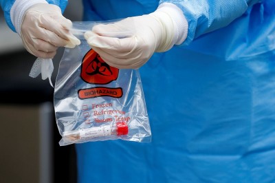500 mil kits de teste rápido do COVID-19 chegam ao Brasil