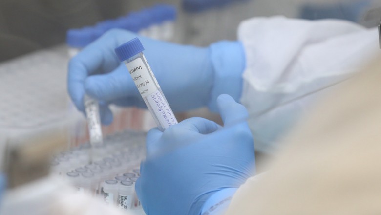 Unidades básicas de saúde de Paranaguá podem realizar exames da Covid-19 a critério médico