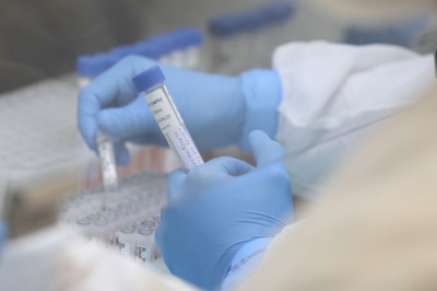 Unidades básicas de saúde de Paranaguá podem realizar exames da Covid-19 a critério médico