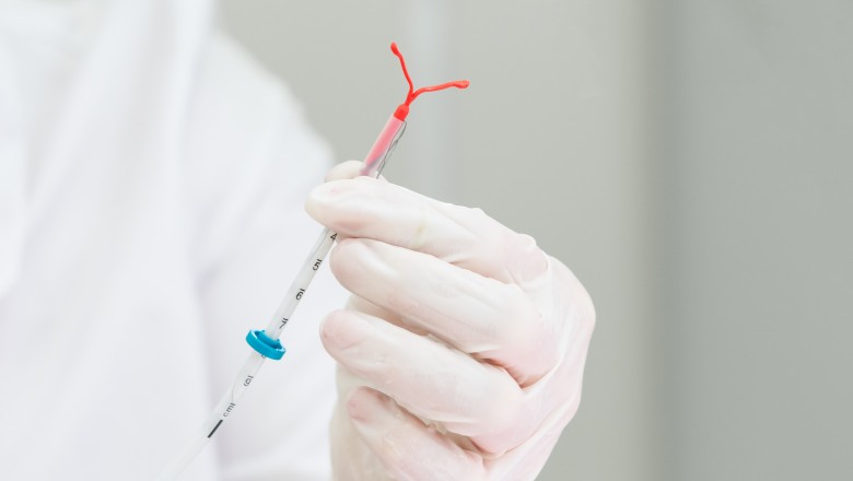 Fasp e Saúde promovem mutirão de colocação de DIU em Paranaguá